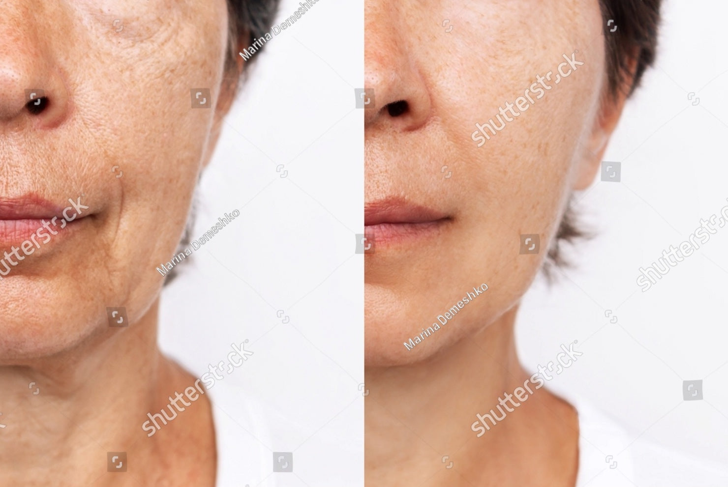 stock-photo-lower-part-of-elderly
