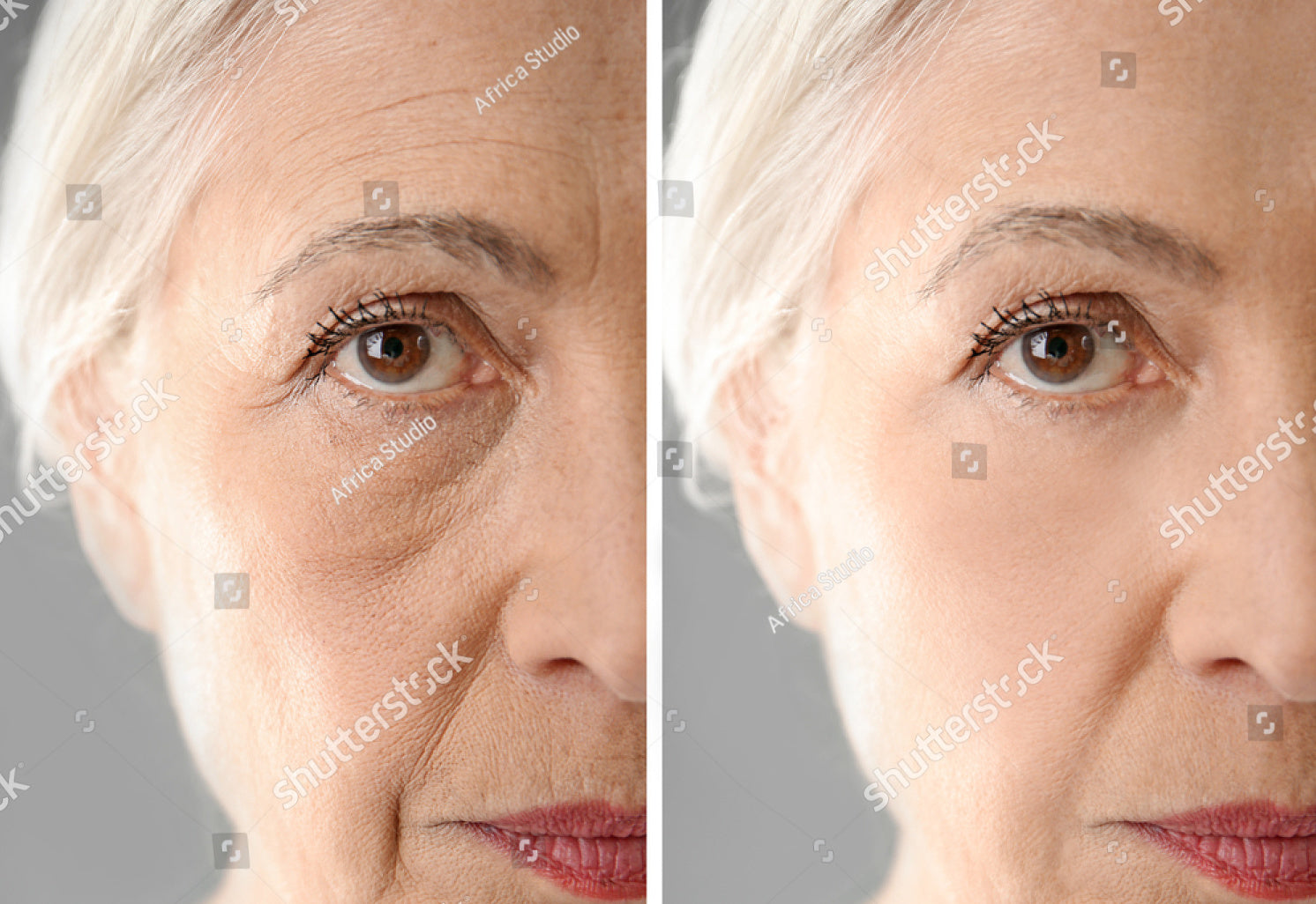 stock-photo-senior-woman-before-and-after-biorevitalization-procedure-closeup-763502896
