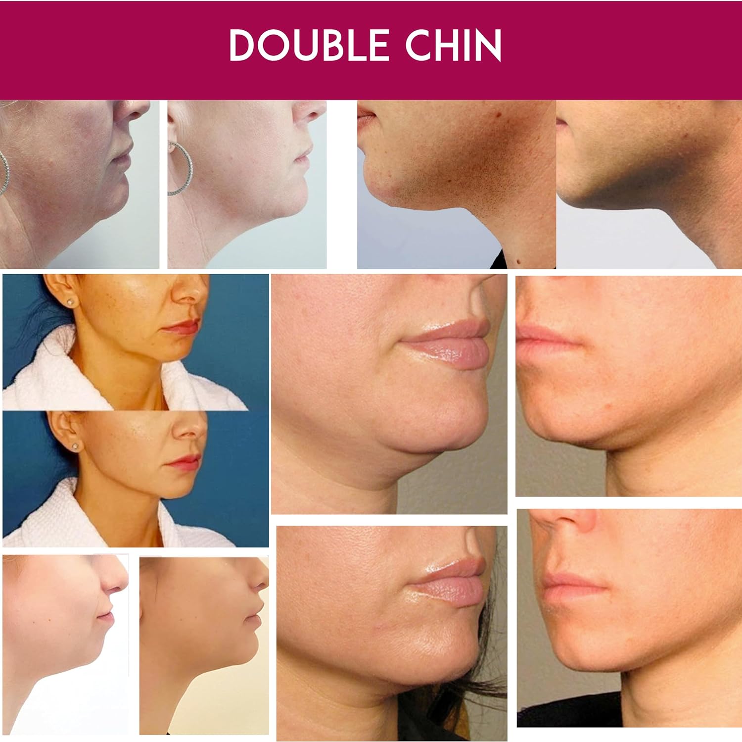 Double Chin Reducer Neck Line Slim - Medactiveshop